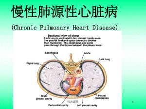 肺心病的护理课件.ppt