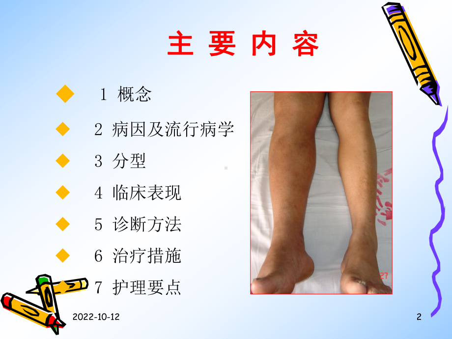 肢dvt的护理课件.ppt_第2页