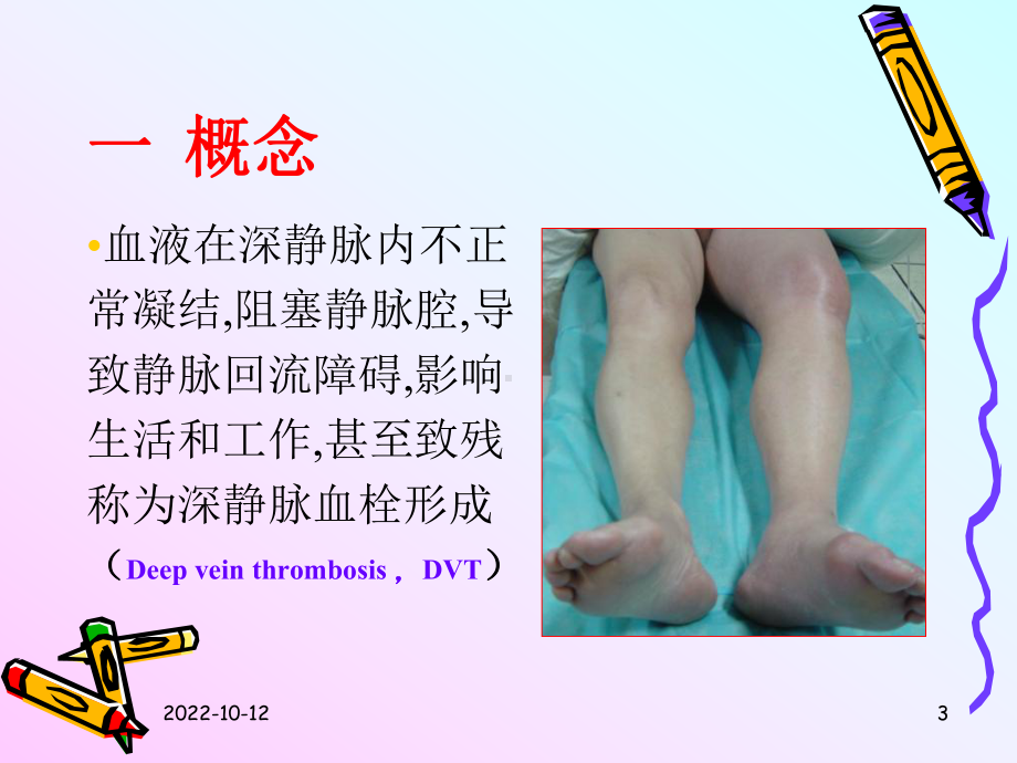 肢dvt的护理课件.ppt_第3页