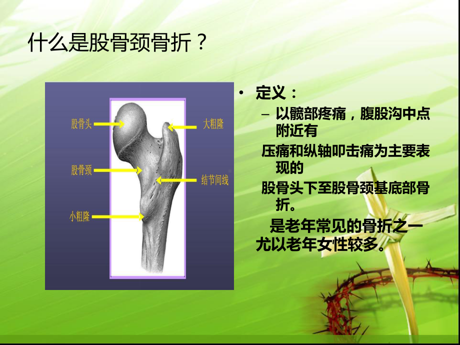 股骨颈骨折的护理zj课件.pptx_第1页