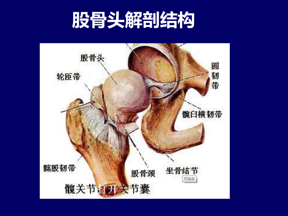 股骨头坏死简介课件.ppt_第2页