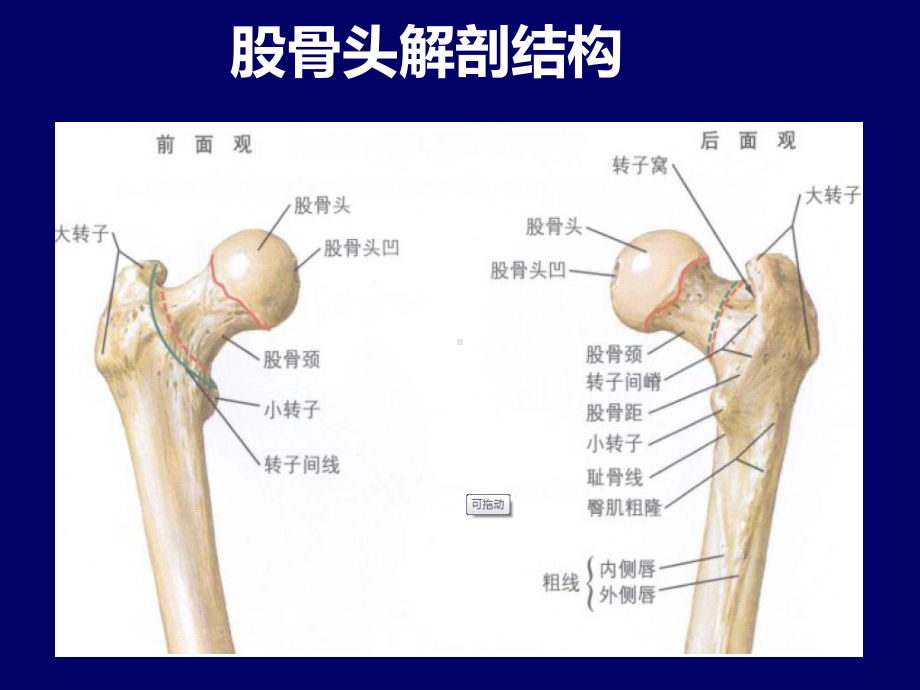 股骨头坏死简介课件.ppt_第3页