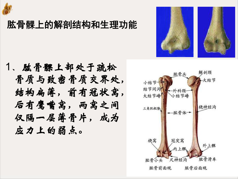 肱骨髁上骨折自制完整讲课课件.ppt_第3页