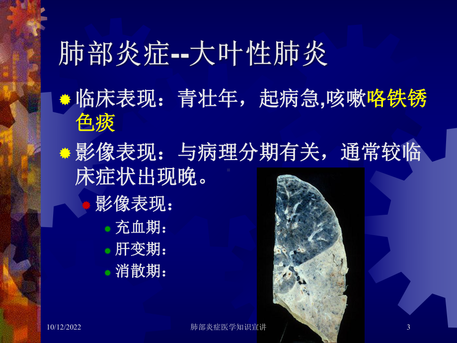 肺部炎症医学知识宣讲培训课件.ppt_第3页