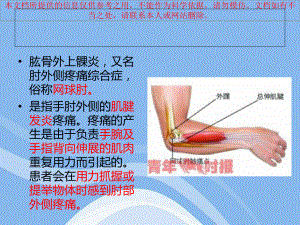 肱骨外上髁炎培训课件.ppt