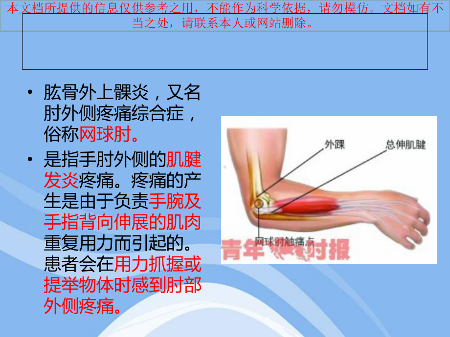 肱骨外上髁炎培训课件.ppt_第1页