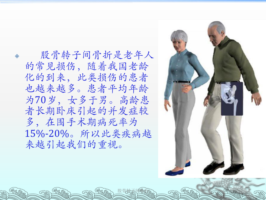 股骨转子间骨折培训课件.ppt_第2页