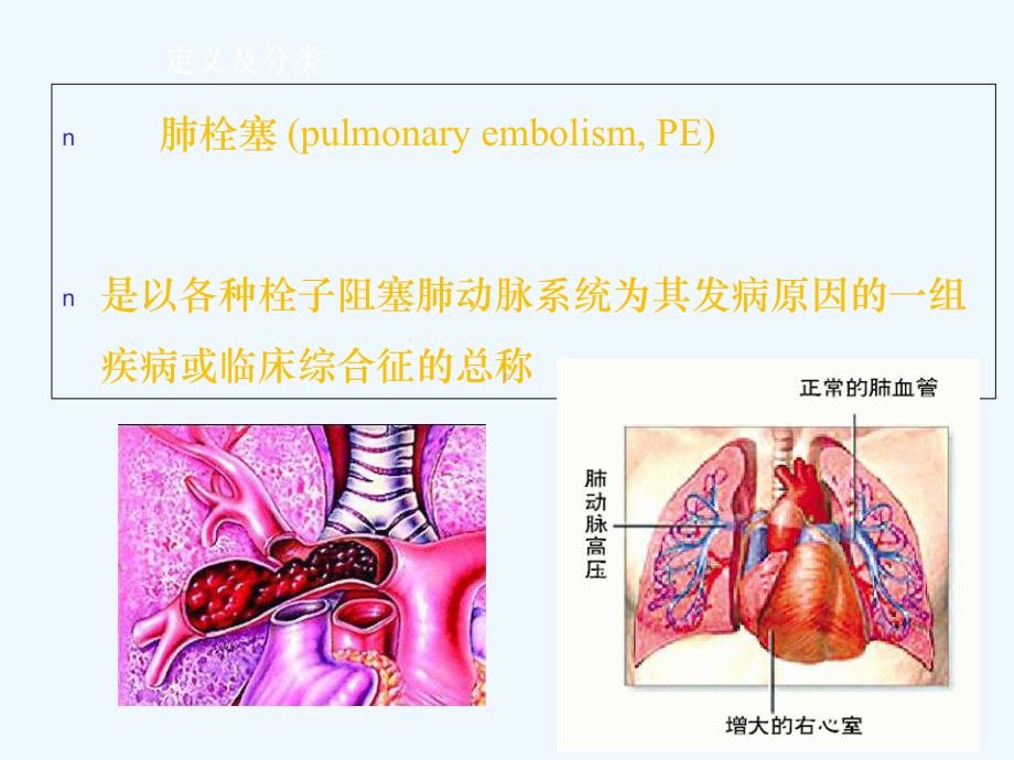 肺栓塞发病机制诊断与处理课件.ppt_第2页