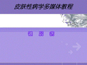 （培训课件）皮肤性病学(银屑病)多媒体教程.ppt