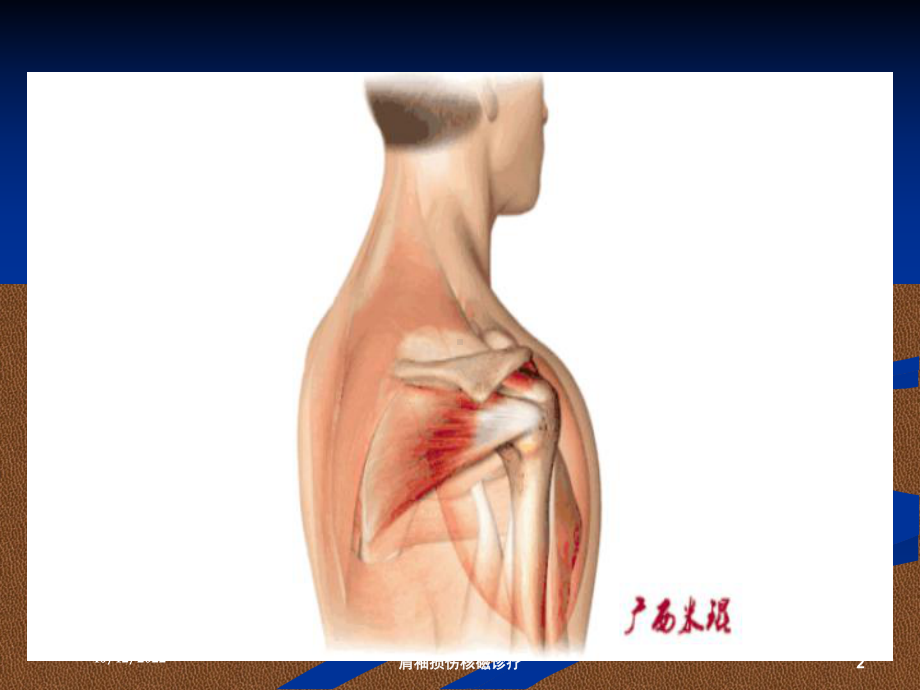 肩袖损伤核磁诊疗培训课件.ppt_第2页