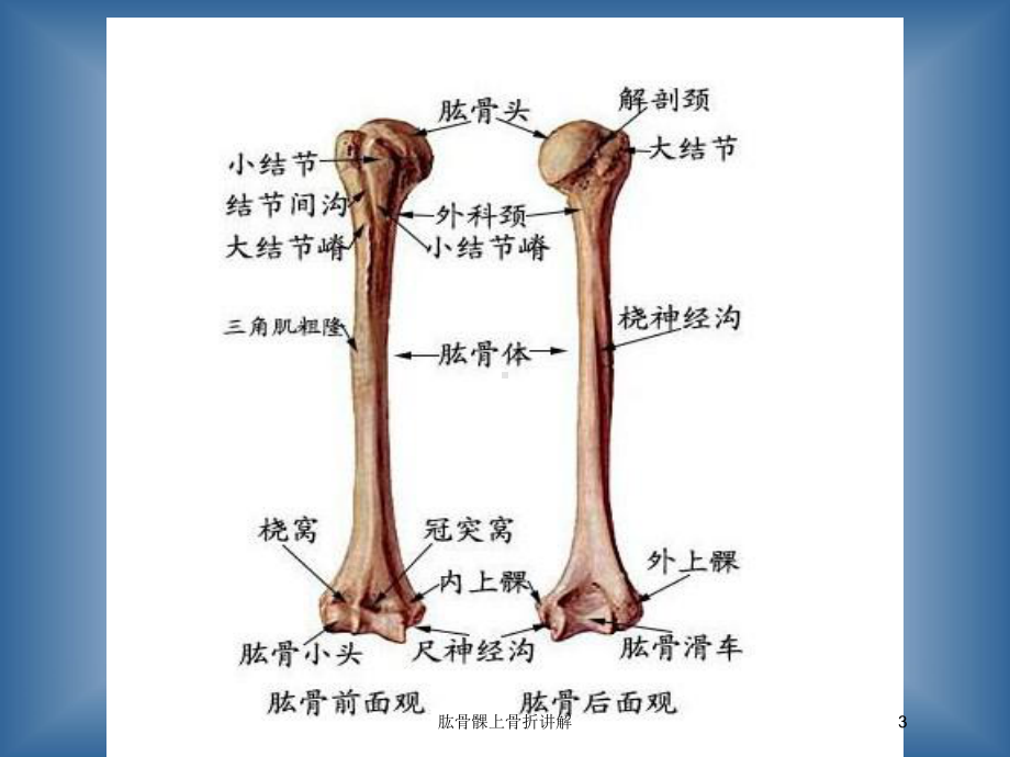 肱骨髁上骨折讲解培训课件.ppt_第3页