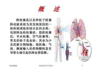 肺栓塞医疗护理查房培训课件.ppt