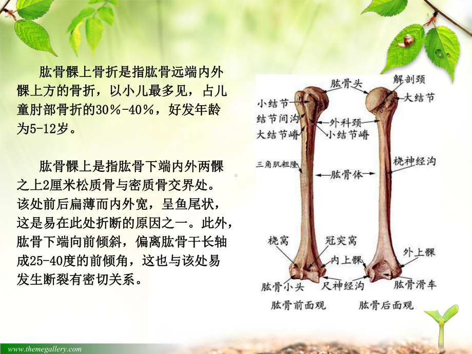 肱骨髁上骨折汇总培训课件.ppt_第2页