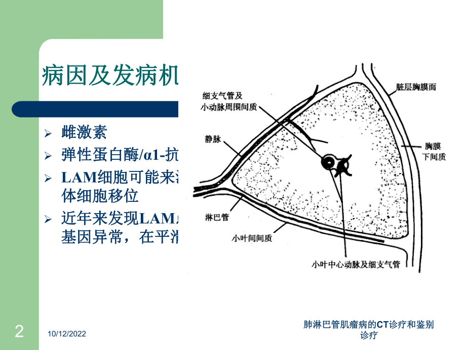 肺淋巴管肌瘤病的CT诊疗和鉴别诊疗培训课件.ppt_第2页