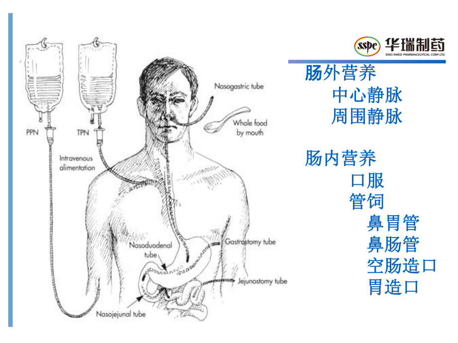 肠外营养配制-转发课件.ppt_第2页