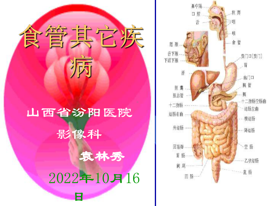 《食管其它疾病》课件.ppt_第1页