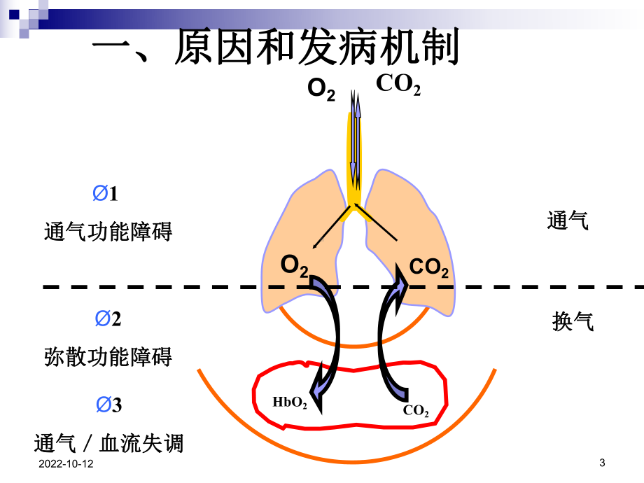 肺功能不全护理课件-2.ppt_第3页