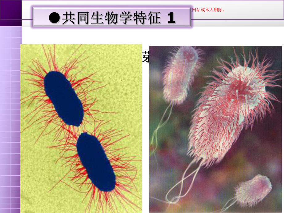 肠道感染细菌医学知识宣教培训课件.ppt_第3页