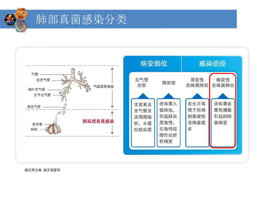 肺部真菌念珠菌感染预见遇见培训课件.ppt_第3页