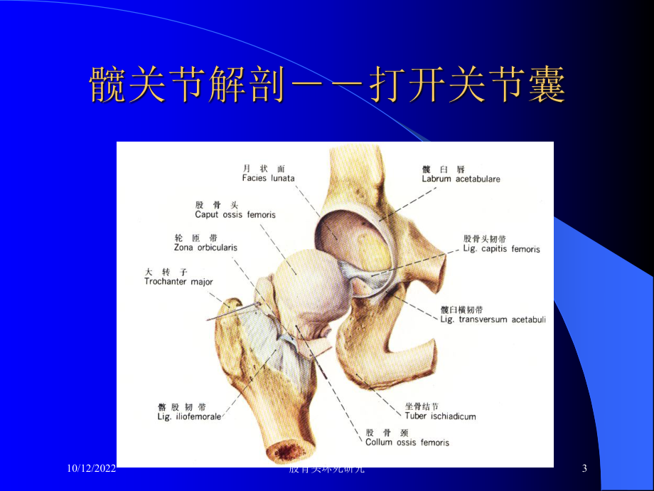 股骨头坏死研究培训课件.ppt_第3页