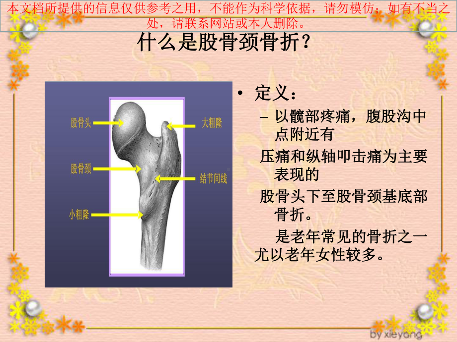 股骨颈骨折的医疗护理培训课件.ppt_第1页