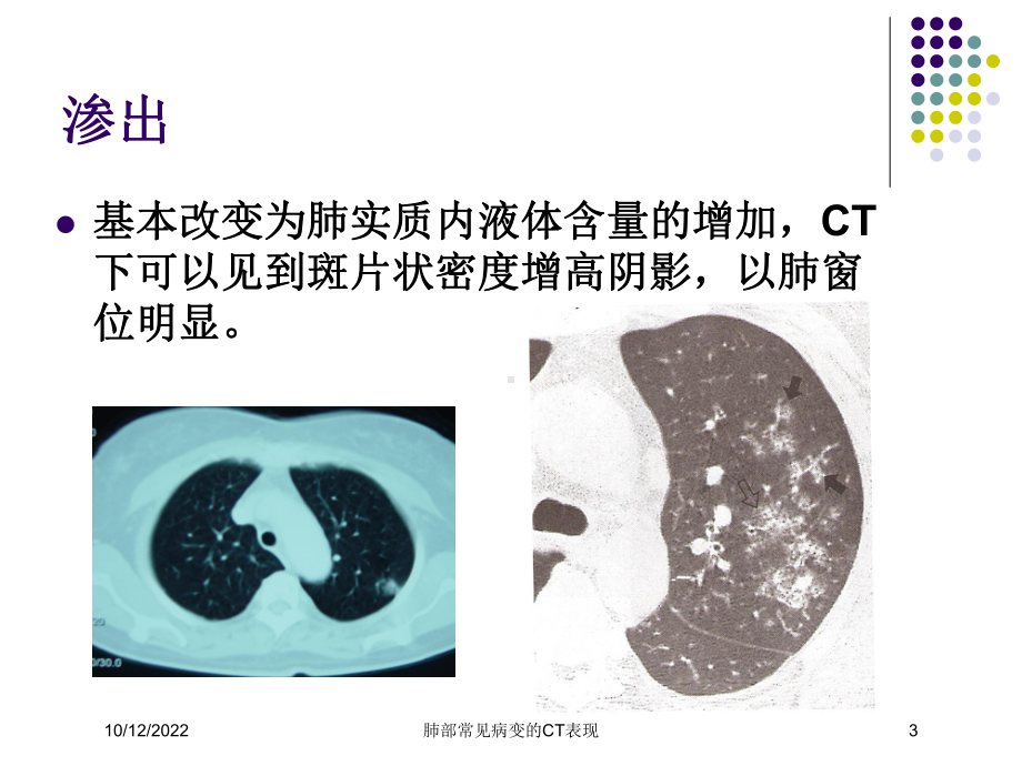 肺部常见病变的CT表现培训课件.ppt_第3页