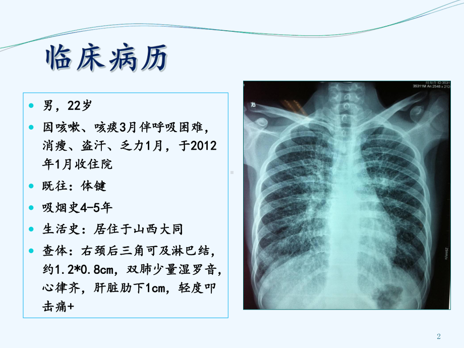 肺癌预防和早期发现课件.ppt_第2页