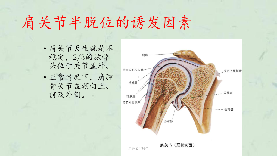 肩关节半脱位课件.ppt_第3页