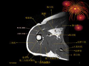 肩关节MRI解剖培训课件.ppt