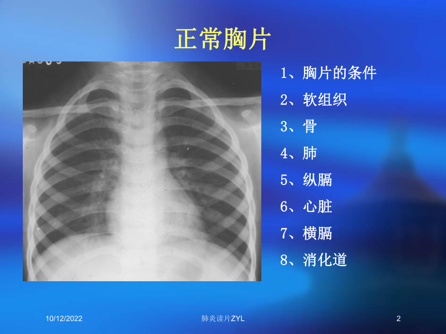 肺炎读片ZYL培训课件.ppt_第2页