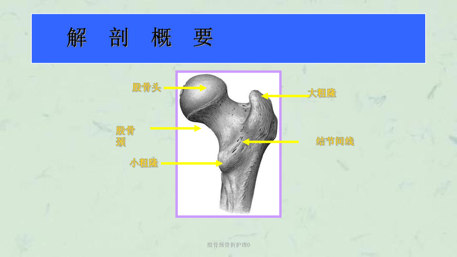 股骨颈骨折护理0课件.ppt_第3页