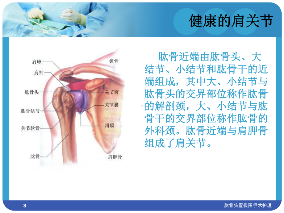 肱骨头置换围手术护理培训课件.ppt_第3页