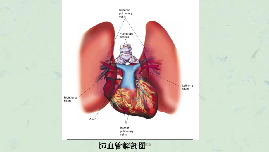 肺血管病理图片及解析课件.ppt_第3页