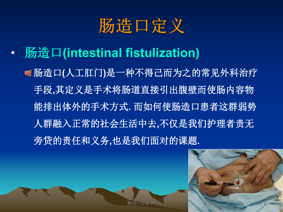 肠造口的护理课件.ppt_第2页