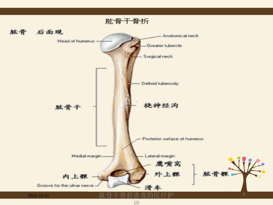 肱骨干骨折患者的医疗护理培训课件.ppt_第3页