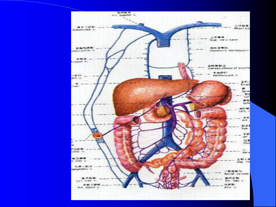 肠梗阻教学小讲座课件.ppt_第3页