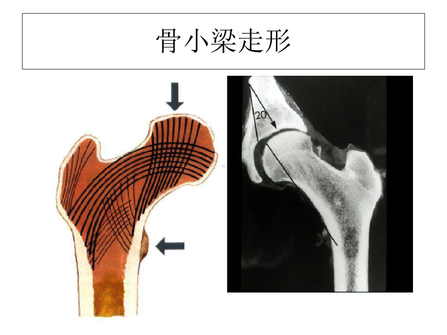 股骨颈骨折：从解剖到手术的全面阐述教材课件.ppt_第2页