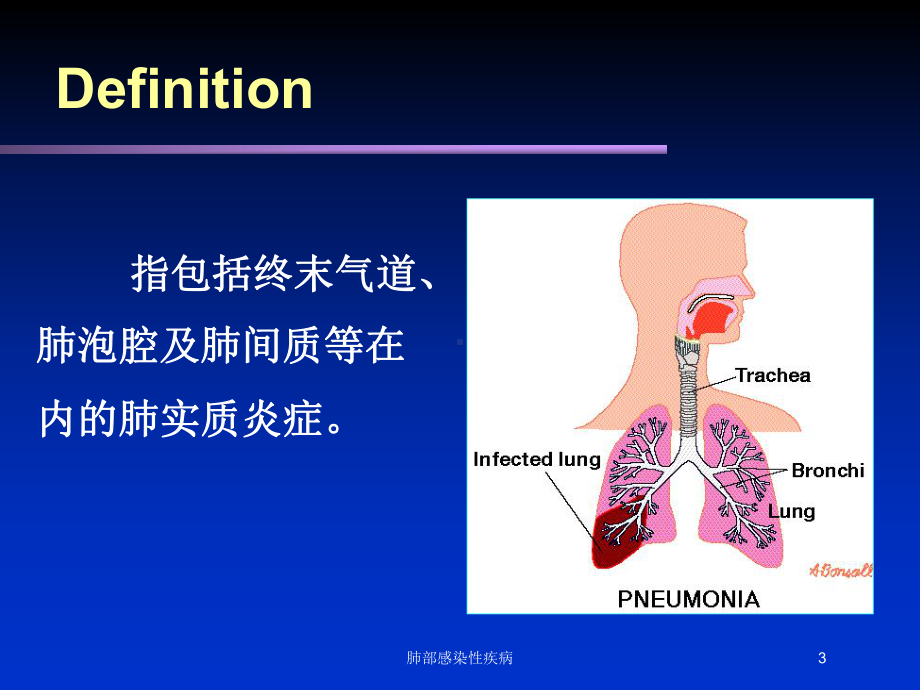 肺部感染性疾病培训课件.ppt_第3页