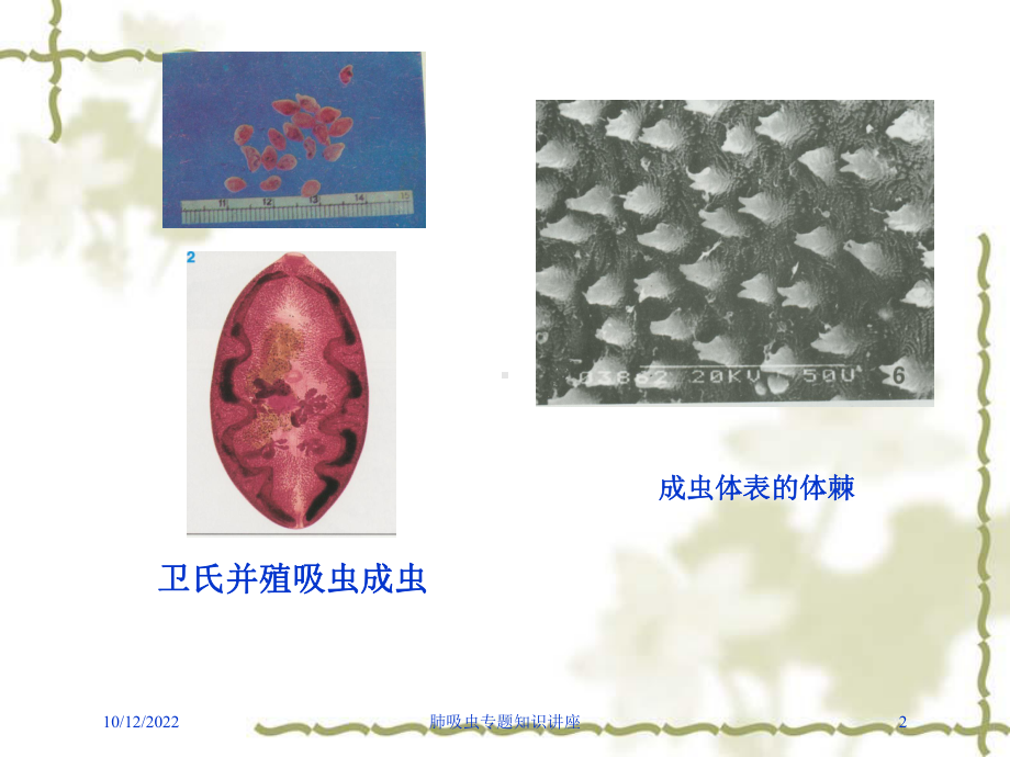 肺吸虫专题知识讲座培训课件.ppt_第2页