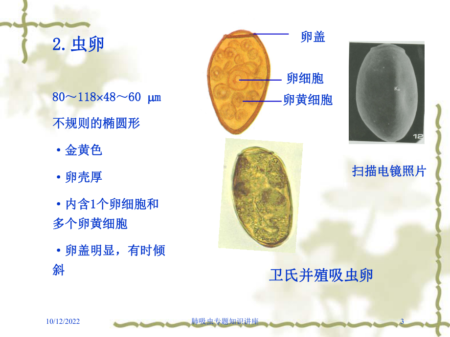 肺吸虫专题知识讲座培训课件.ppt_第3页