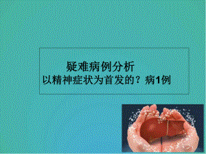 肝豆状核变性病例一例医学课件.ppt