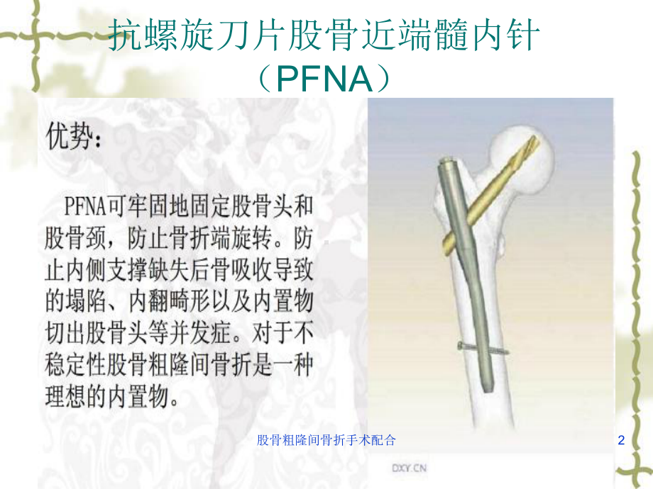 股骨粗隆间骨折手术配合培训课件.ppt_第2页