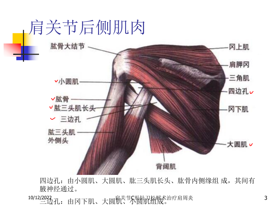 肩关节C形针刀松解术治疗肩周炎培训课件.ppt_第3页