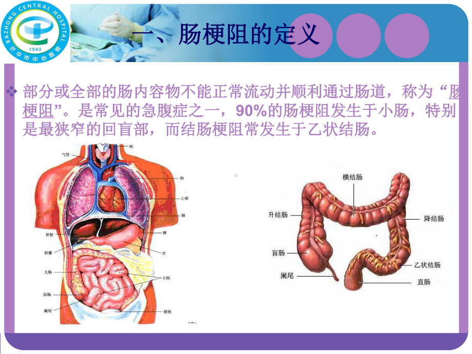 肠梗阻护理查房[1]-课件1.ppt_第2页