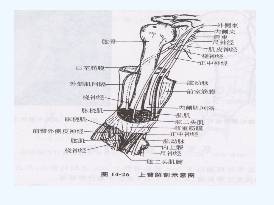 肱骨骨折护理查房-课件2.ppt_第3页