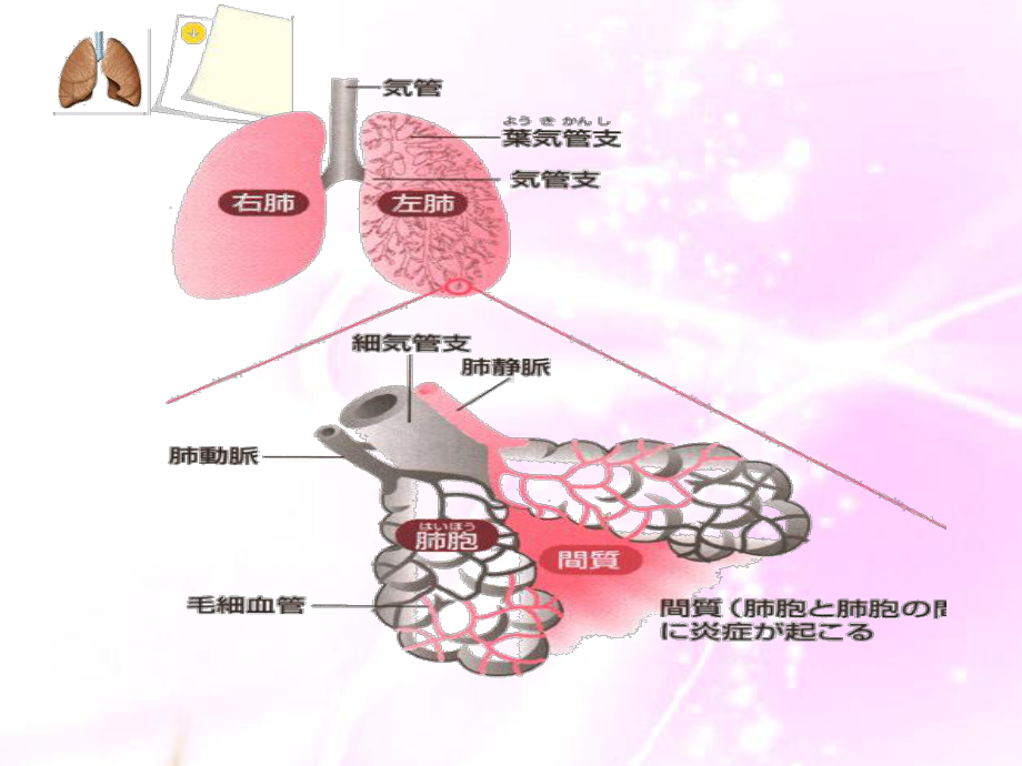 肺炎病人的医疗护理讲义课件.ppt_第3页