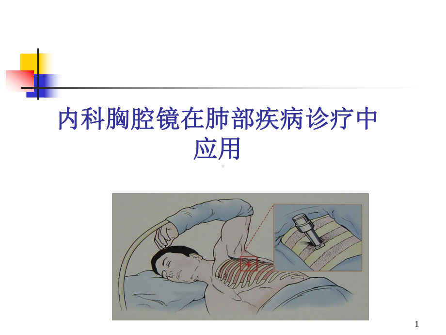 内科胸腔镜课件.ppt_第1页