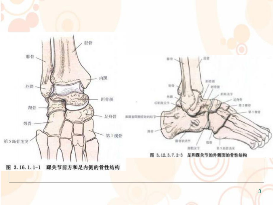 三踝骨折参考课件.ppt_第3页