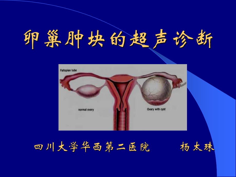 卵巢肿块的超声诊断课件.ppt_第1页