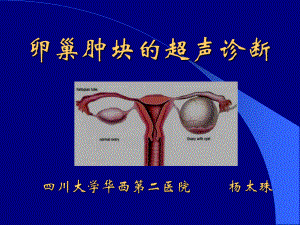 卵巢肿块的超声诊断课件.ppt